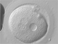 Abbildung 5: Zygote - Vorkernmuster