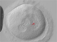 Abbildung 6: Zygote - Vorkernmuster