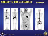 Abbildung 2: Fluorid-PET-CT