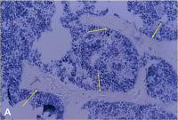 Abbildung 2-a: Proximale Tibia