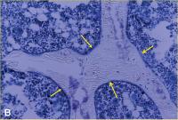 Abbildung 2-b: Proximale Tibia