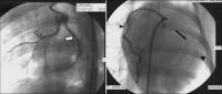 Abbildung 1: Arteria coronaria - Hausschwein