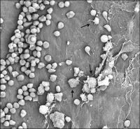 Abbildung 8: Stentimplantation - Thrombosebildung