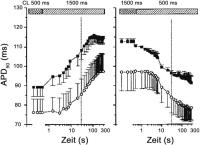Abbildung 2-c: Vorhofflimmern - Aktionspotential