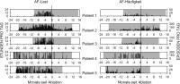 Abbildung 4: Arrhythmie-Last - Arrhythmie-Hufigkeit