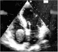 Figure 1: Transthoracic echocardiography
