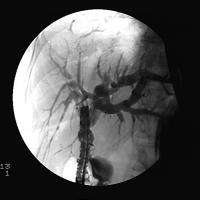 Abbildung 2: Ductus hepaticus