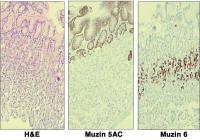 Abbildung 2: Apomucin 5AC - Apomucin 6