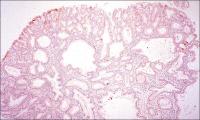 Abbildung 7: PGA - Apumucin 5AC
