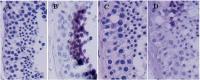 Abbildung 3a-d: Spermatogenese