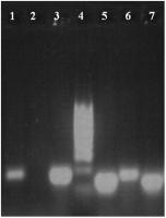 Abbildung 4: RT-PCR - Protamin 1