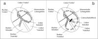 Abbildung 2a-b: Tachykardien - Zykluslnge