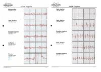 Abbildung 5: Defibrillationsbeispiele