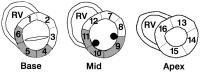 Figure 1: Wall motion analysis