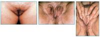 Abbildung 4: Transsexualitt
