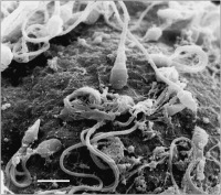Abbildung 2: Spermatozoon - Akrosomenkappe