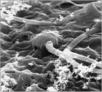 Abbildung 3: Spermatozoon - Zona pellucida