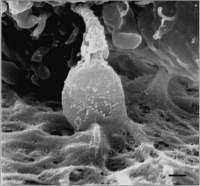 Abbildung 4: Spermatozoon - Zona pellucida