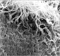 Abbildung 5-b: Spermatozoon