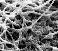 Abbildung 6: Spermatozoon - Zona pellucida