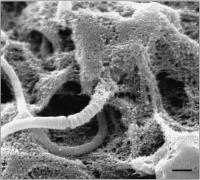 Abbildung 8: Spermatozoon - Zona pellucida