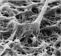 Abbildung 9: Spermatozoon - Zona pellucida