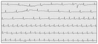 Abbildung 3: EKG