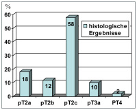 Abbildung 1: Prostatektomie - Histologie