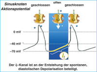 Abbildung 1: If-Kanal