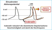 Abbildung 2: If-Kanal