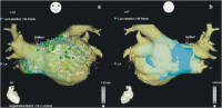 Abbildung 3: CT-Bild - CartoMergeTM-Map