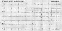 Abbildung 1: Aufnahme-EKG