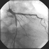 Abbildung 3: Angiogramm