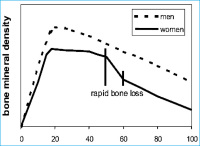Abbildung 1: Bone loss