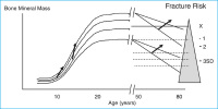Abbildung 1: Fracture - Aging