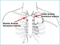 Abbildung 2: Arteria thoracica interna