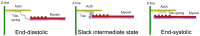 Figure 1: End-diastolic - End-systolic