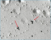Abbildung 2: Freeze fracture immunogold labelling