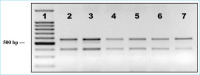 Abbildung 2: RT-PCR