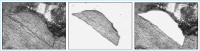 Abbildung 3: Laser Capture Microdissection Microscopy