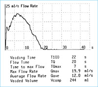 Abbildung 1: Uroflowmetry