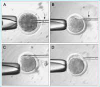 Abbildung 3: Somatic cell nuclear transfer