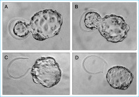 Abbildung 9: Blastocysts - Mouse embryo