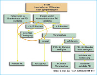 Abbildung 1: STEMI-ESP-PCI