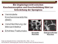 Abbildung 4: RANKL/RANK/OPG-System