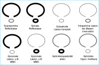 Abbildung 2: Neurogene motorische Lsionstypen