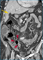 Abbildung 3: MDCT - 3D-Rekonstruktion