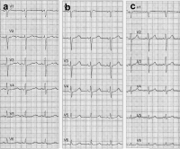Abbildung 2: EKG