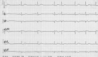 Abbildung 2a: EKG