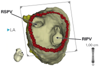 Abbildung 3: CARTO-Merge